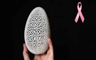 Low-cost hope with 3D breast prosthesis design