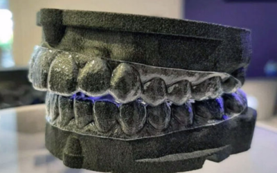 Recycled plastic denture molds are a reality